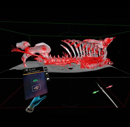 ImmersiveTouch's technology allows surgeons to practice in a virtual world. Photo: ImmersiveTouch